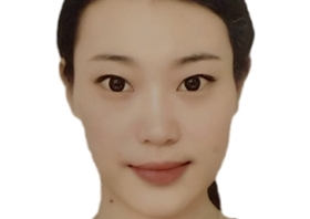 王璇
